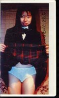 ひとみシミができやすいの(B-01)